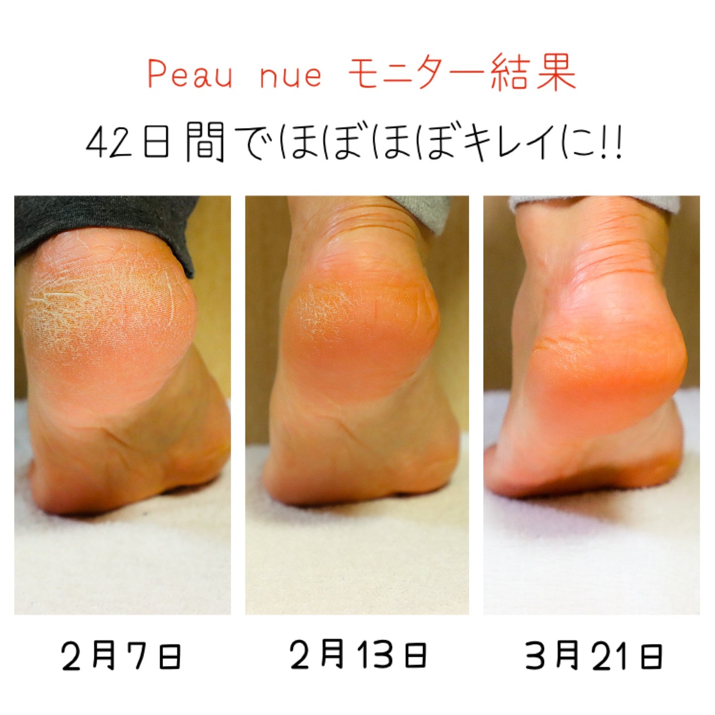 Peau nue キャンペーン 2個25%off